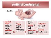 Omphalocele