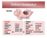 Omphalocele PowerPoint Presentation