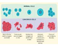 Anticancer Drug Medical Notes