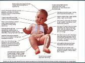 Abnormal Rhythm in Children