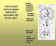 Neuromodulation for Chronic Pain PowerPoint Presentation