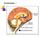 Alcohol problems in the elderly PowerPoint Presentation