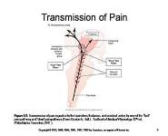 Comfort and Sedation PowerPoint Presentation
