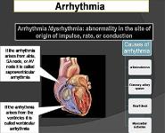 Antiarrhythmic Drugs PowerPoint Presentation