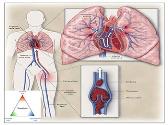 Acute Pulmonary Embolism-Diagnosis and Management