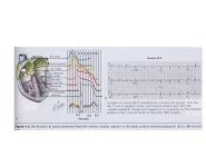 Mechanisms of Cardiac Arrhythmias PowerPoint Presentation