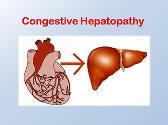Congestive Hepatopathy Case Presentation