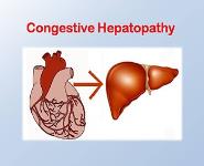 Congestive Hepatopathy Case Presentation PowerPoint Presentation Notes