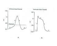 Cardiac Arrhythmias PowerPoint Presentation