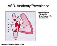 Adult Congenital Heart Disease PowerPoint Presentation