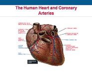 Early Heart Attack Care PowerPoint Presentation Notes