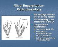 Valvular Heart disease  PowerPoint Presentation