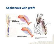 Presentation and management of cardiac surgical diseases  PowerPoint Presentation