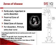 Educational Session on Tevar-Complex Evar in the VQI  PowerPoint Presentation Notes
