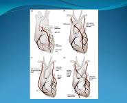 Arterial conduits in coronary artery bypass grafting: an inconvenient truth PowerPoint Presentation