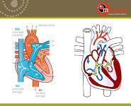 Diagnosis and treatment RHD  PowerPoint Presentation
