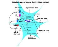 Neuroprotection for Surgery-Is it Possible PowerPoint Presentation