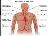Nursing Care Plan of Aortic Aneurysm 