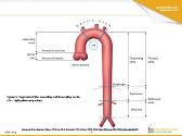 The Aorta 101 