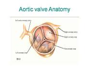 Valve Surgery PowerPoint Presentation Notes