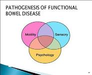 Recurrent Abdominal Pain in Children PowerPoint Presentation Notes