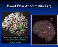 Learning Disorders or Disabilities or Differences PowerPoint Presentation Notes
