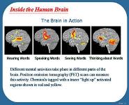 Alzheimers Disease-Unraveling the Mystery PowerPoint Presentation Notes