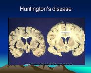 Single-Gene Disorders PowerPoint Presentation Notes