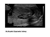 Prenatal Diagnosis