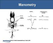 Constipation Diseases PowerPoint Presentation
