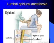 Anesthesiology Intensive Care Medicine And Resuscitation PowerPoint Presentation Notes