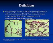 Acute Respiratory Distress Syndrome PowerPoint Presentation