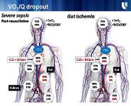 Management of Sepsis PowerPoint Presentation