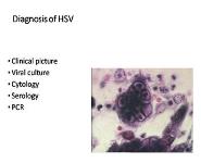 Human Herpes Viruses-HHV PowerPoint Presentation Notes