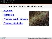 Properties of the Hair and Scalp