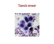 Immunobullous disorders PowerPoint Presentation Notes