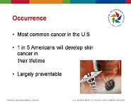 Skin Cancer PowerPoint Presentation