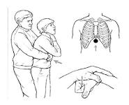 Basic Airway Management PowerPoint Presentation
