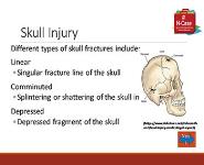 Acute Traumatic Brain Injury Nursing Self-Paced Case Study PowerPoint Presentation Notes