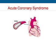 Acute Coronary Syndrome PowerPoint Presentation Notes