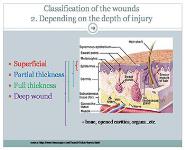 Classification and management of wound principle of wound healing haemorrhage and bleeding control PowerPoint Presentation