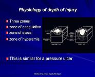 Burn and Wound Management PowerPoint Presentation