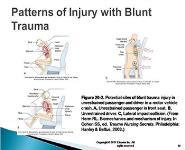 Trauma and Surgical Management PowerPoint Presentation Notes