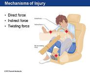 Musculoskeletal Injuries PowerPoint Presentation