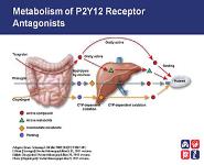 Acute Coronary Syndrome-In Hospital Antiplatelet Management PowerPoint Presentation