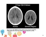 Young children and trauma PowerPoint Presentation