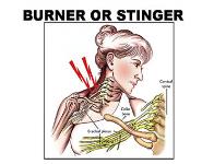 Neck Injury PowerPoint Presentation Notes