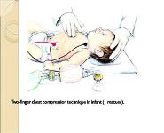 Pediatric CPR PowerPoint Presentation