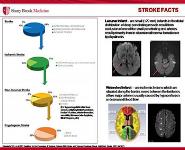 Stroke PowerPoint Presentation