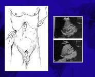 Management of the Trauma Patient PowerPoint Presentation